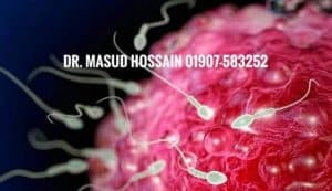 পুরুষের বন্ধ্যাত্ব চিকিৎসায় হোমিওপ্যাথি Infertility Homeo Treatment Dr. Masud Hossain 01907-583252