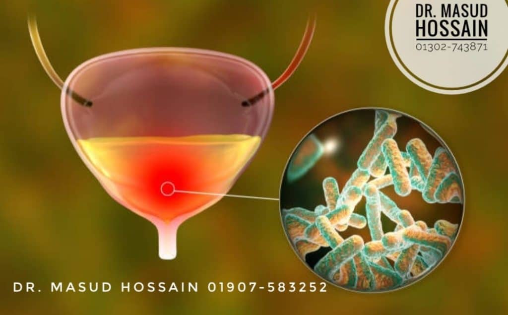 সিস্টাইটিস - Homeo Treatment of Cystitis