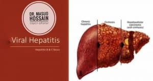 হেপাটাইটিস বি Hepatitis B homeopathic treatment