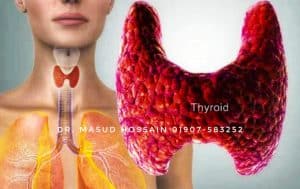থাইরয়েড হরমোনের রোগ। Thyroid gland best homeo treatment