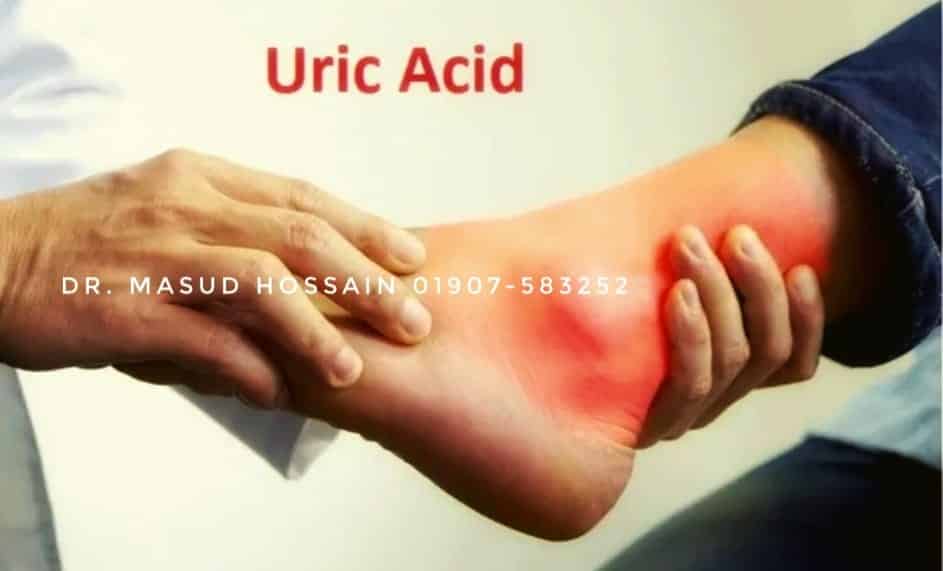 রক্তে ইউরিক এসিড Uric Acid In Blood 1