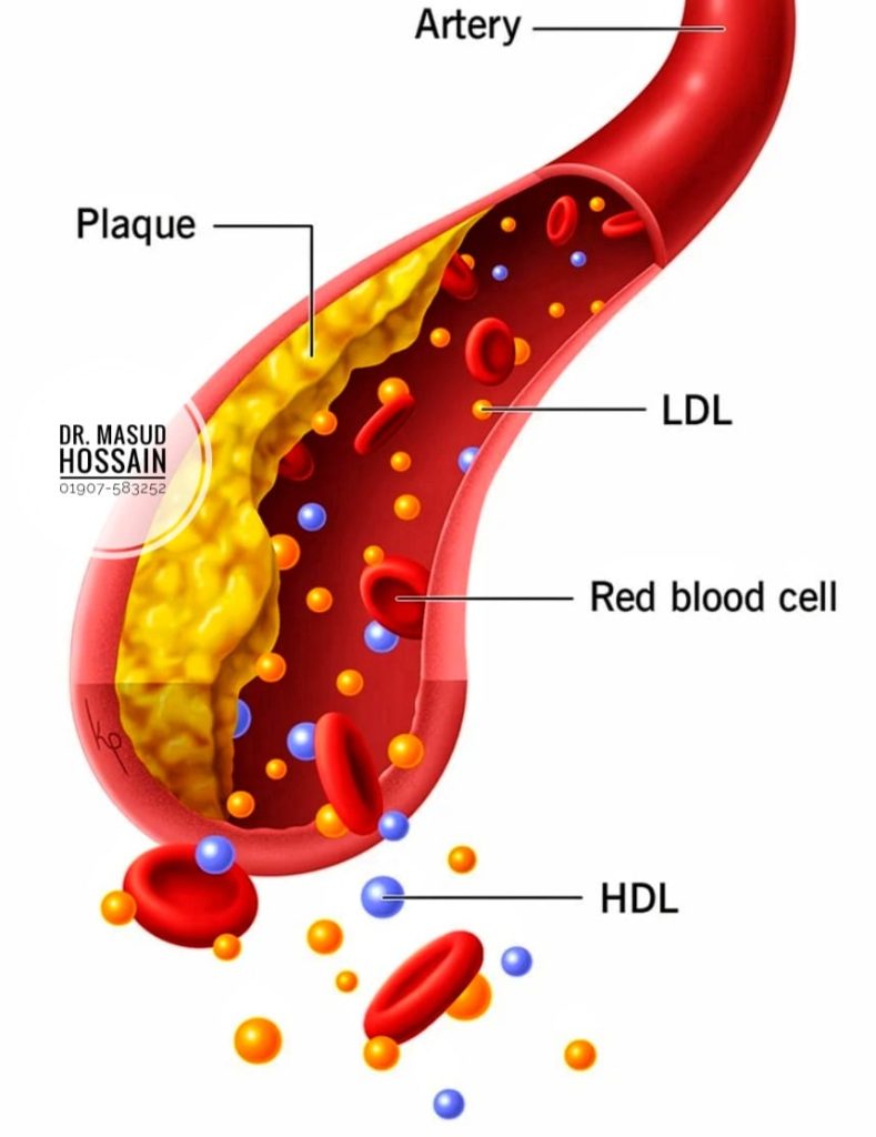 রক্তের কোলেস্টেরল | Blood Colostorol & Homeo Treatment