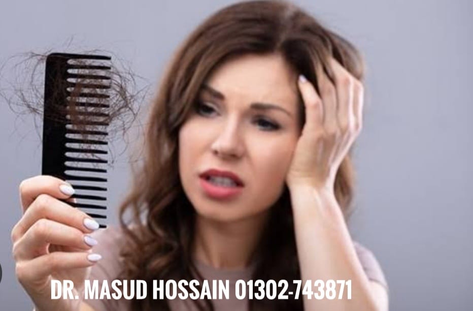 চুল পড়ায় হোমিও চিকিৎসা | Hair Fall Homeo Treatment | ডাঃ মাসুদ হোসেন।
