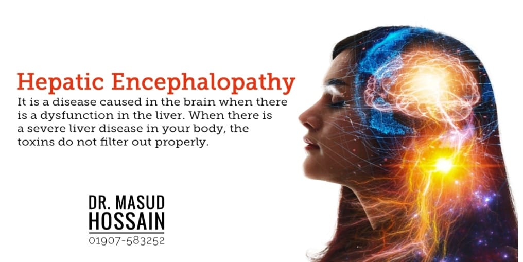 হেপাটিক এনসেফালোপ্যাথি | Hepatic Encephalopathy | ডাঃ মাসুদ হোসেন।