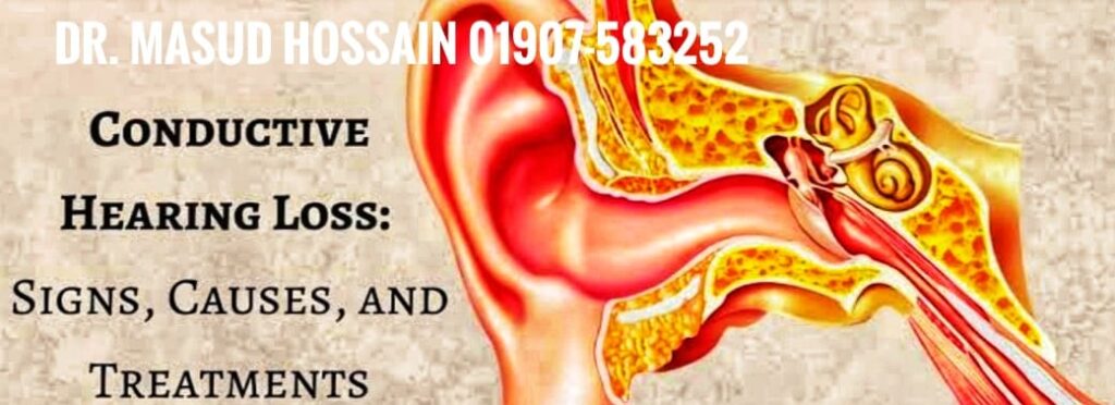 Conductive Hearing Loss | ডাঃ মাসুদ হোসেন। 4 Conductive Hearing Loss | ডাঃ মাসুদ হোসেন।