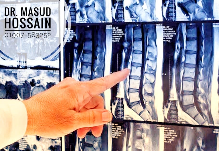 স্পাইনাল কর্ড - Spinal Cord Injury