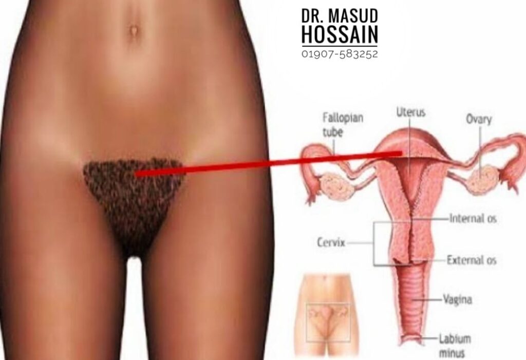 āĻŽāĻšāĻŋāϞāĻžāĻĻā§āϰ āϝā§āύāĻžāĻā§āĻā§ āĻāĻāĻāĻŋāϞā§āϰ āĻšā§āĻŽāĻŋāĻ āĻāĻŋāĻāĻŋā§āϏāĻžāĨ¤ 4 āĻŽāĻšāĻŋāϞāĻžāĻĻā§āϰ āϝā§āύāĻžāĻā§āĻā§ āĻāĻāĻāĻŋāϞā§āϰ āĻšā§āĻŽāĻŋāĻ āĻāĻŋāĻāĻŋā§āϏāĻžāĨ¤