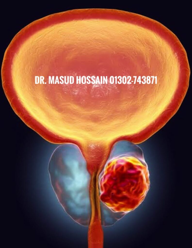 ⭕ হেমাটোস্পার্মিয়া - ( hematospermia ) রোগের ট্রিটমেন্ট কি? 3 ⭕ হেমাটোস্পার্মিয়া - ( hematospermia ) রোগের ট্রিটমেন্ট কি?